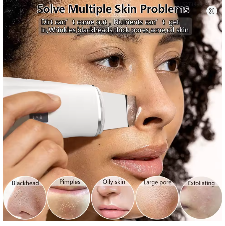 Ultrasonic Skin Cleaner – Blackheads and Dead Skin Remover